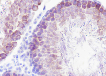 STIP1 Recombinant Rabbit Monoclonal Antibody