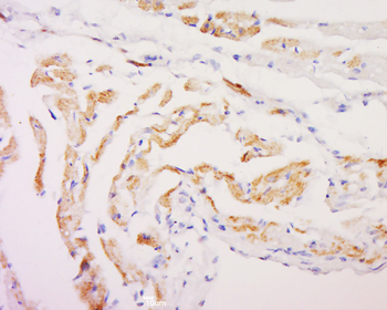 HIGD1C Rabbit Polyclonal Antibody