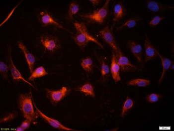 Vimentin Rabbit Polyclonal Antibody (BF555)