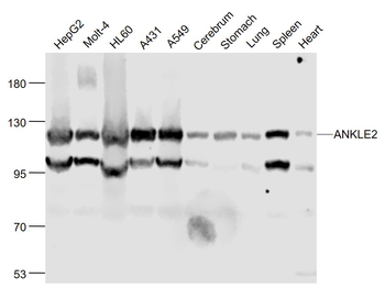 ANKLE2 Rabbit Polyclonal Antibody