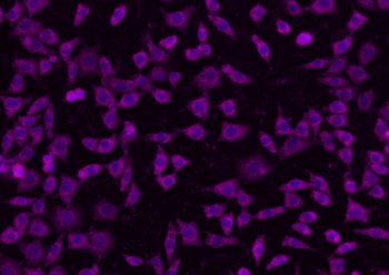 EGFRvIII Rabbit Polyclonal Antibody (BF647)