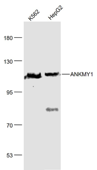 ANKMY1 Rabbit Polyclonal Antibody