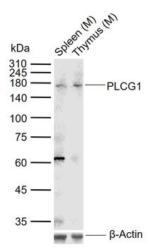 PLCG1 Rabbit Polyclonal Antibody