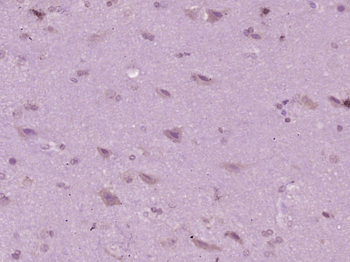 HLA Class 1 ABC/HLA ABC Rabbit Polyclonal Antibody