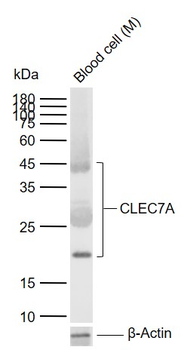 CLEC7A Rabbit Polyclonal Antibody