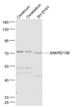 ANKRD13B Rabbit Polyclonal Antibody