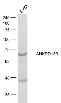 ANKRD13B Rabbit Polyclonal Antibody