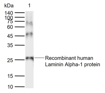 Laminin alpha 1 Rabbit Polyclonal Antibody
