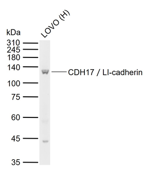 CDH17/LI-cadherin Rabbit Polyclonal Antibody
