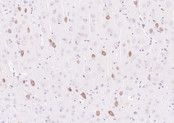 FLRT3 Rabbit Polyclonal Antibody