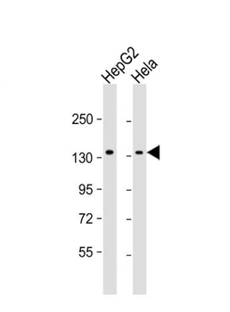 RBM6 Mouse Monoclonal Antibody