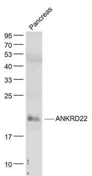 ANKRD22 Rabbit Polyclonal Antibody