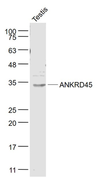 ANKRD45 Rabbit Polyclonal Antibody