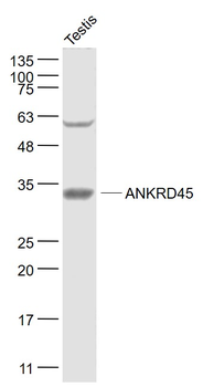 ANKRD45 Rabbit Polyclonal Antibody