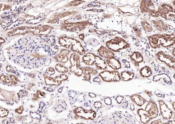 RBP4 Mouse Monoclonal Antibody