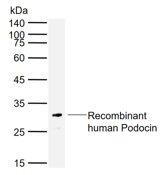 NPHS2 Rabbit Polyclonal Antibody