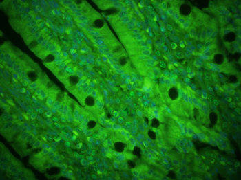 IL-5 Rabbit Polyclonal Antibody (BF488)