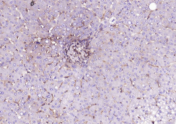 HLA-C Mouse Monoclonal Antibody