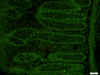 TUSC3 Rabbit Polyclonal Antibody (BF488)