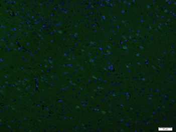 Argonaute 3 Rabbit Polyclonal Antibody (BF488)