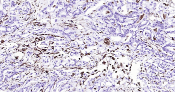 Human Vimentin Ready-To-Use IHC Kit