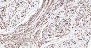 Alpha smooth muscle Actin Ready-To-Use IHC Kit