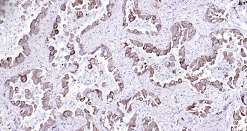 Human Cytokeratin 7 Ready-To-Use IHC Kit