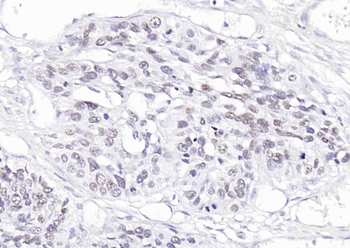 P63 Recombinant Rabbit Monoclonal Antibody