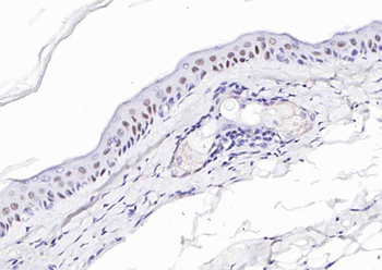 P63 Recombinant Rabbit Monoclonal Antibody