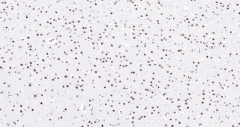 MYBL2 Ready-To-Use IHC Kit