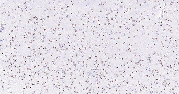 MYBL2 Ready-To-Use IHC Kit