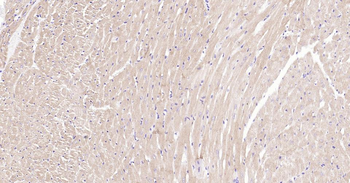 MYH6 Recombinant Rabbit Monoclonal Antibody