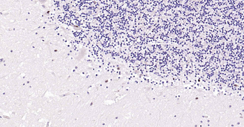 SOX1 Recombinant Rabbit Monoclonal Antibody