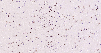 SOX1 Recombinant Rabbit Monoclonal Antibody