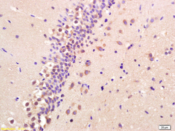 BNP Rabbit Polyclonal Antibody