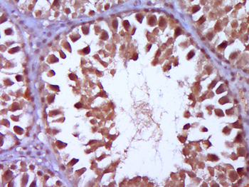 WT1 Rabbit Polyclonal Antibody