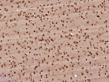 HnRNP A2B1 Rabbit Polyclonal Antibody