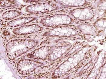 HnRNP A2B1 Rabbit Polyclonal Antibody