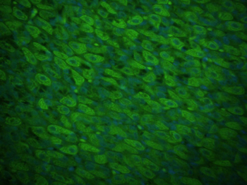 Spectrin alpha chain, non-erythrocytic 1 Rabbit Polyclonal Antibody (FITC)