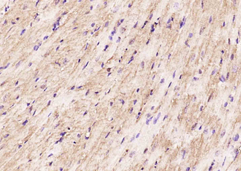 GPS1 Rabbit Polyclonal Antibody