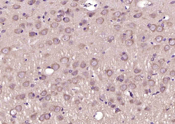 GPS1 Rabbit Polyclonal Antibody
