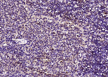 GPS1 Rabbit Polyclonal Antibody