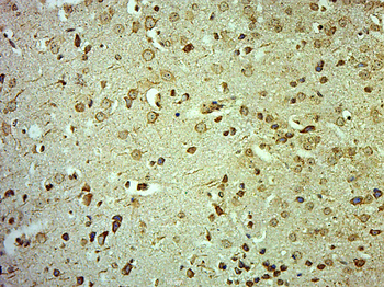 CLCN3 Rabbit Polyclonal Antibody