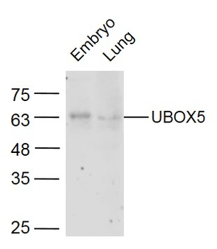 UBOX5 Rabbit Polyclonal Antibody