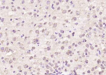 TRIM41 Rabbit Polyclonal Antibody