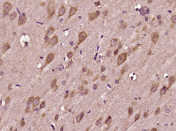 RNF142 Rabbit Polyclonal Antibody