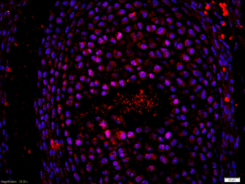 RNF13 Rabbit Polyclonal Antibody