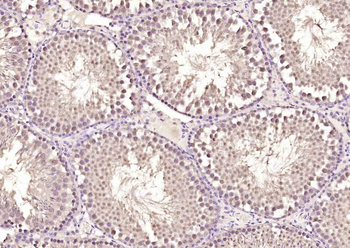 ZNF354C Rabbit Polyclonal Antibody