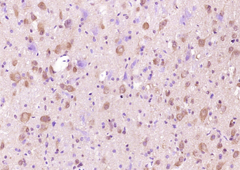 WDFY3 Rabbit Polyclonal Antibody
