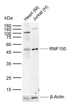 RNF150 Rabbit Polyclonal Antibody